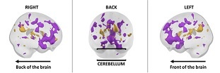 cerebellum3_311