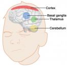 Computational model to seek an explanation for the neurological basis for Tourettes Syndrome.