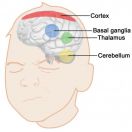 Computational model to seek an explanation for the neurological basis for Tourettes Syndrome. 